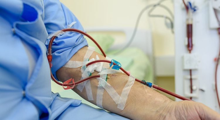 Pasien Cuci Darah Panduan Aman Mudik Lebaran 2025