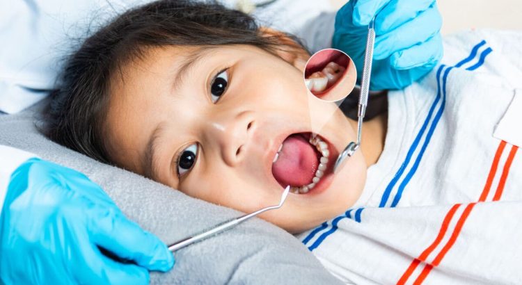 Kesehatan Gigi Pengaruh Faktor Genetik Pada Anak