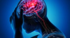 Gejala Stroke Kenali Gejala Awal dan Cara Efektif Mencegahnya