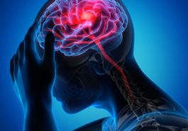 Gejala Stroke Kenali Gejala Awal dan Cara Efektif Mencegahnya