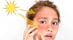Sinar UV dan Dampaknya bagi Kesehatan Kulit
