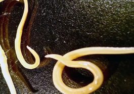 Cacing Gelang yang Menginfeksi Raya, Bocah Sukabumi