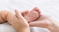 KLB Campak di Indonesia Ancaman Serius Jika Imunisasi Turun